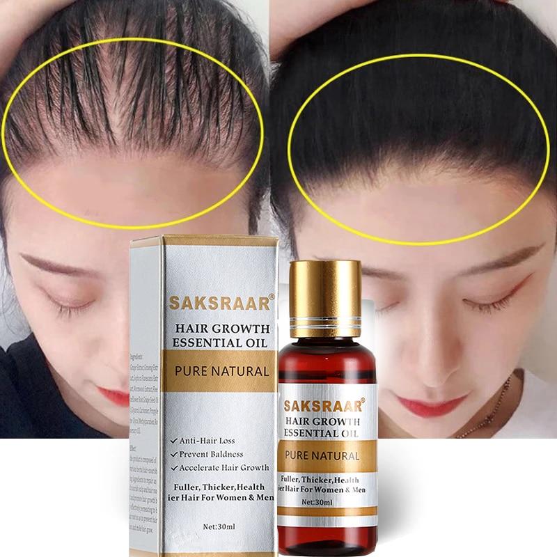 Hair care for men and women Miracle product for hair regrowth This oil is very effective in helping you recover your hair